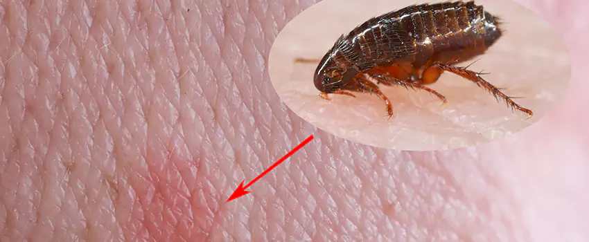 Flea Control for Humans Pasadena, CA